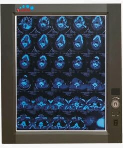 Negatoscopio sencillo LED MP-ZG1 (SOBRE PEDIDO)